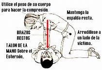 La Reanimación Cardiopulmonar (RCP)