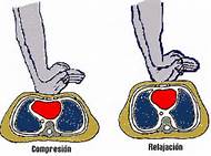 La Reanimación Cardiopulmonar (RCP)